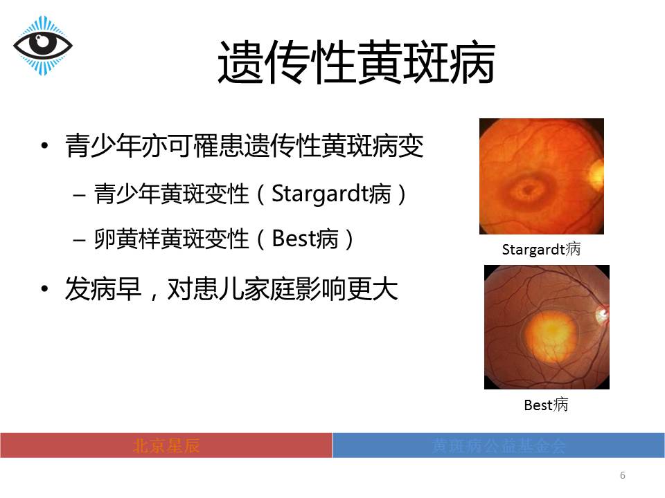 为何建立该基金会 – 北京星辰黄斑病公益基金会